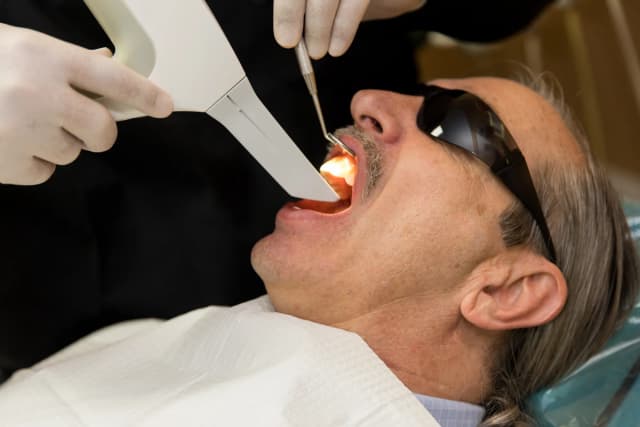 Upper Jaw Dental Implant Surgery - DAY 3
