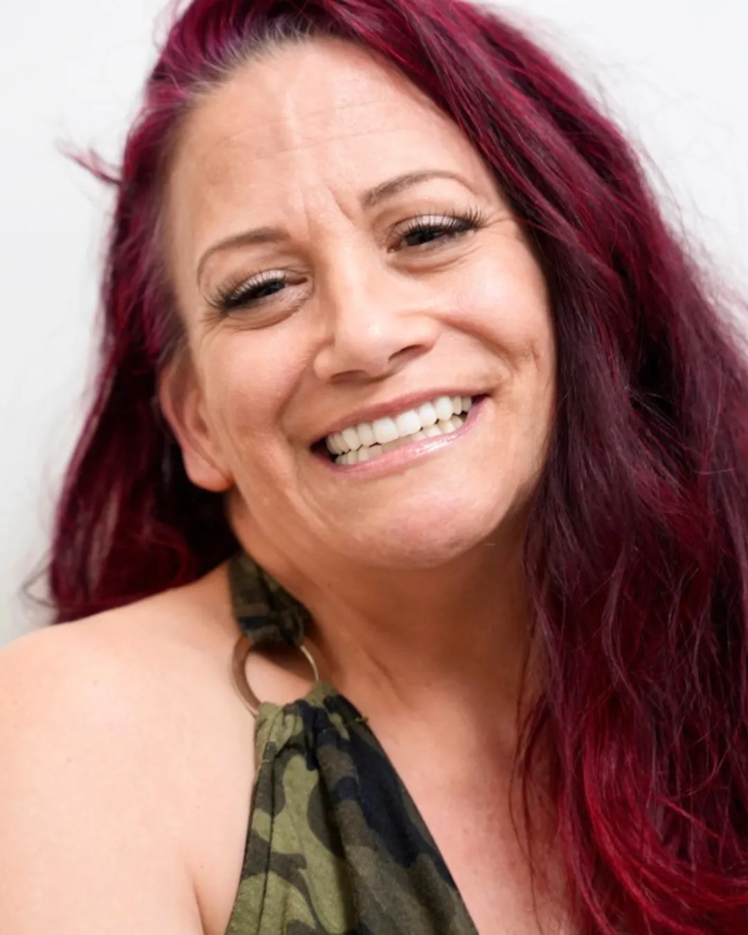 Denise dental implant smile transformation after treatment